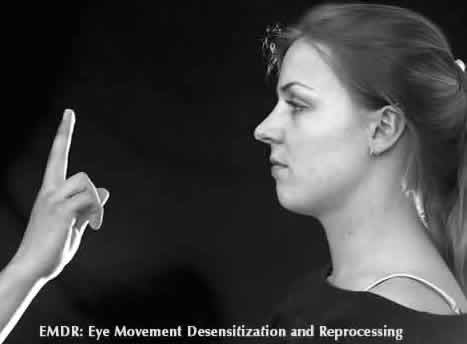 emdr1